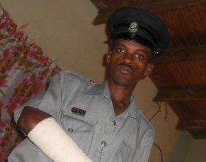 Dominican policeman shot in St. Kitts loses leg